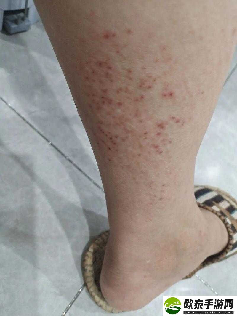 求助