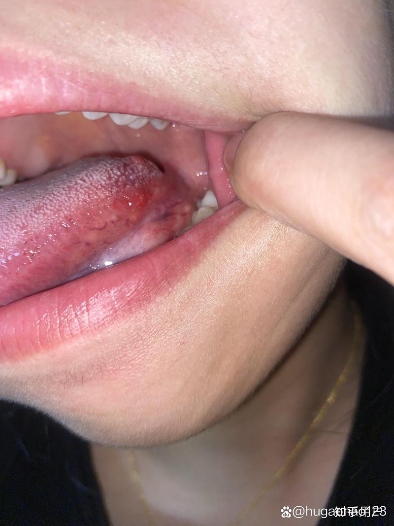 舌头进入口腔感受小豆豆