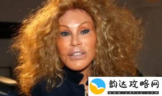整容成“猫女”的瑞士名媛因心脏衰竭去世