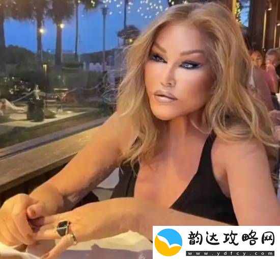 整容成“猫女”的瑞士名媛因心脏衰竭去世